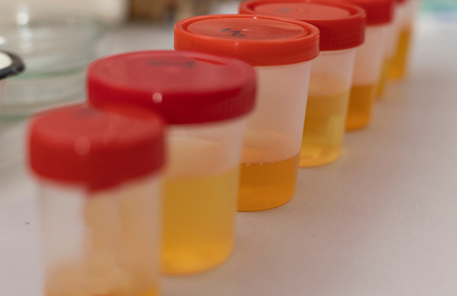 Drug test kits - a series of drug test cups with urine samples for workplace drug testing